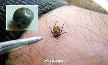 男子釣魚感覺(jué)手腕有小蟲 拍死后瞬間雙手起皰潰爛