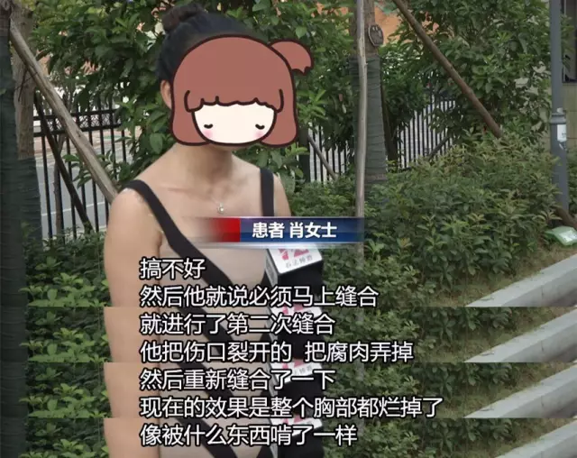 女子花近十萬做豐胸手術(shù) 術(shù)后胸部潰爛似被啃