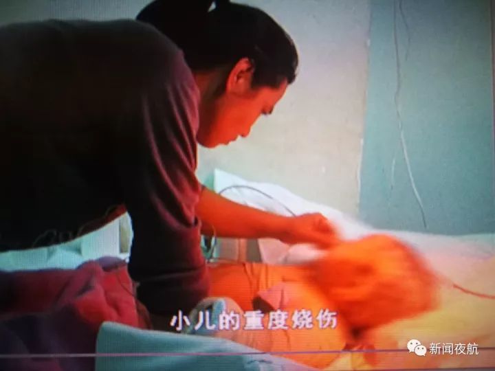 3歲半女孩掉進熱水鍋 奶奶發(fā)現(xiàn)拽住孩子兩腿撈出