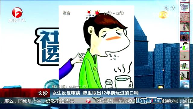 女生反復(fù)咳痰 肺里取出12年前玩過(guò)的口哨